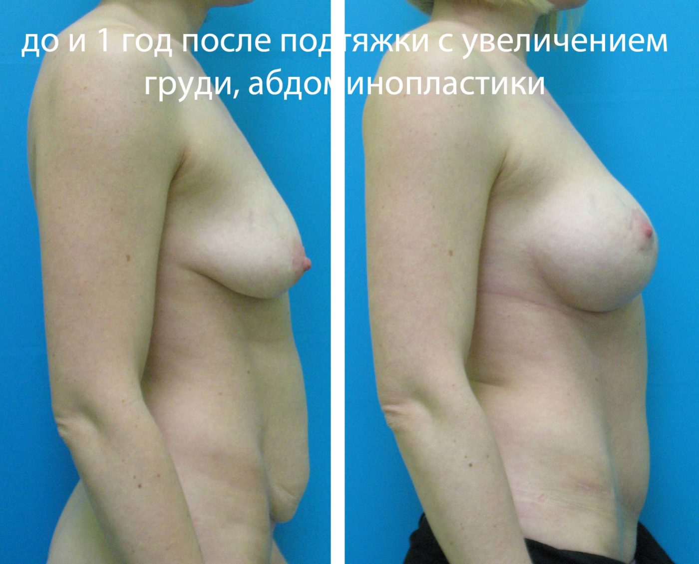 что отвечает за рост груди у женщин фото 72